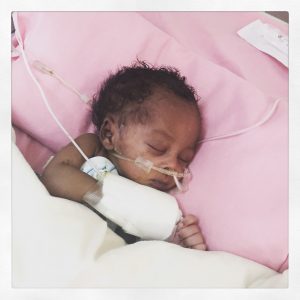 Joseph, healing from gastroschisis